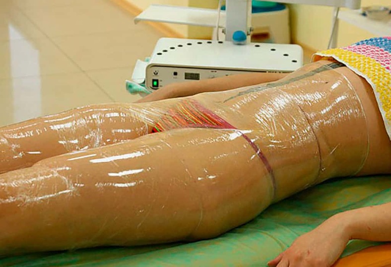 Как сделать домашнее обертывание для похудения живота Как сделать домашнее обертывание для похудения живота